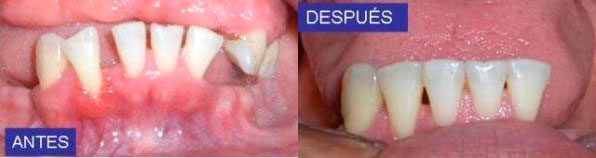 https://dentalreynosa.com/wp-content/uploads/2022/04/ortodoncia-caso1.jpg
